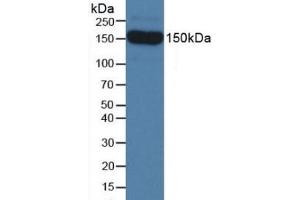 Detection of SEMA5B in Mouse Serum using Polyclonal Antibody to Semaphorin 5B (SEMA5B) (SEMA5B anticorps  (AA 836-1013))
