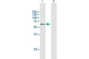 Western Blot analysis of GAD2 expression in transfected 293T cell line by GAD2 MaxPab polyclonal antibody.