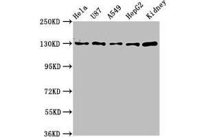 Western Blot Positive WB detected in: Hela whole cell lysate, U87 whole cell lysate, A549 whole cell lysate, HepG2 whole cell lysate, Mouse kidney tissue All lanes: SLC12A2 antibody at 6.