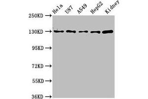 Western Blot Positive WB detected in: Hela whole cell lysate, U87 whole cell lysate, A549 whole cell lysate, HepG2 whole cell lysate, Mouse kidney tissue All lanes: SLC12A2 antibody at 6. (SLC12A2 anticorps  (AA 110-282))