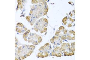 Immunohistochemistry of paraffin-embedded human stomach using ITPKB antibody (ABIN5972108) at dilution of 1/100 (40x lens). (ITPKB anticorps)