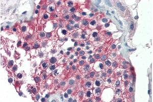 ABIN185587 (5µg/ml) staining of paraffin embedded Human Testis. (ALDH1A1 anticorps  (Internal Region))