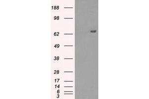 HEK293T cells were transfected with the pCMV6-ENTRY control (Left lane) or pCMV6-ENTRY HDAC10 (Right lane) cDNA for 48 hrs and lysed. (HDAC10 anticorps)
