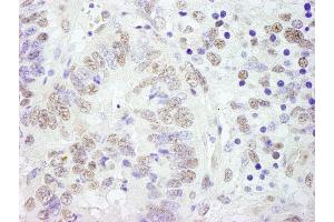 Immunohistochemistry (IHC) image for anti-Cleavage Stimulation Factor, 3' Pre-RNA, Subunit 3, 77kDa (CSTF3) (AA 667-717) antibody (ABIN7448498)