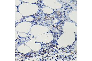Immunohistochemistry of paraffin-embedded rat lung using iNOS Rabbit pAb  at dilution of 1:100 (40x lens). (NOS2 anticorps  (AA 500-730))