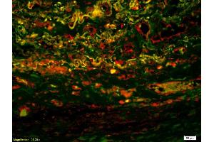 Formalin-fixed and paraffin-embedded human lung labeled with Anti-IL-2R gamma Polyclonal Antibody, Unconjugatedused at 1:200 dilution for 40 minutes at 37°C.