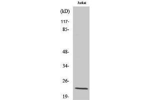 Western Blotting (WB) image for anti-Tumor Protein D52-Like 2 (TPD52L2) (C-Term) antibody (ABIN3174699) (TPD52L2 anticorps  (C-Term))