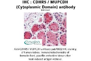 Image no. 2 for anti-Mucin and Cadherin-Like (CDHR5) (Cytoplasmic Domain) antibody (ABIN1732922) (CDHR5 anticorps  (Cytoplasmic Domain))
