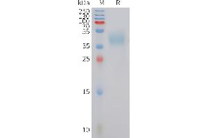 Human MC4R Protein, hFc Tag on SDS-PAGE under reducing condition.
