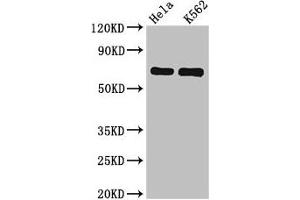 Western Blot Positive WB detected in: Hela whole cell lysate, K562 whole cell lysate All lanes: SNX9 antibody at 6.