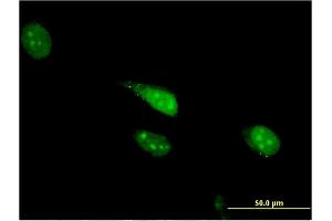 Immunofluorescence of monoclonal antibody to CDC23 on HeLa cell. (CDC23 anticorps  (AA 491-591))