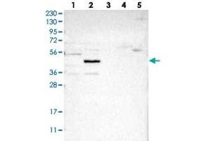 Western blot analysis of Lane 1: RT-4, Lane 2: U-251 MG, Lane 3: Human Plasma, Lane 4: Liver, Lane 5: Tonsil with NSUN5 polyclonal antibody  at 1:250-1:500 dilution. (NSUN5 anticorps)