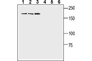 Western blot analysis of human SH-SY5Y neuroblastoma cell line lysate (lanes 1 and 4), human  MG glioblastoma cell line lysate (lanes 2 and 5) and human Jurkat T cell leukemia cell line lysate (lanes 3 and 6):1-3. (SLIT1 anticorps  (Secreted))