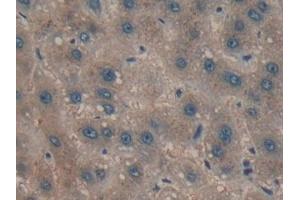 Detection of CYP-40 in Human Liver cancer Tissue using Polyclonal Antibody to Cyclophilin 40 (CYP-40)