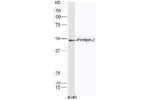 A549 lysate probed with Rabbit Anti-Perilipin 2 Polyclonal Antibody, Unconjugated  at 1:5000 for 90min at 37˚C. (ADRP anticorps  (AA 341-437))