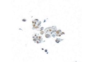 Immunocytochemistry (ICC) image for anti-BRCA1 Associated Protein-1 (Ubiquitin Carboxy-terminal Hydrolase) (BAP1) (AA 475-525) antibody (ABIN7795816)