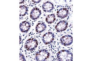 DUT Antibody immunohistochemistry analysis in formalin fixed and paraffin embedded human colon tissue followed by peroxidase conjugation of the secondary antibody and DAB staining.