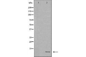 Western blot analysis of extracts of MB435, using HAMP antibody.