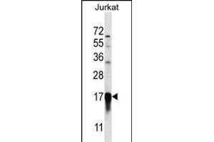 PFDN5 Antibody (Center) (ABIN657046 and ABIN2846213) western blot analysis in Jurkat cell line lysates (35 μg/lane). (PFDN5 anticorps  (AA 79-108))