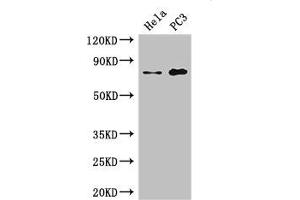 Western Blot Positive WB detected in: Hela whole cell lysate, PC-3 whole cell lysate All lanes: STRBP antibody at 2. (STRBP anticorps  (AA 201-500))