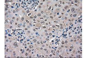 Immunohistochemical staining of paraffin-embedded Ovary tissue using anti-SLC18A2 mouse monoclonal antibody.