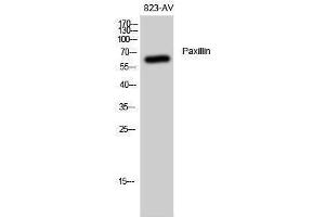 Western Blotting (WB) image for anti-Paxillin (PXN) (Thr508) antibody (ABIN3186344) (Paxillin anticorps  (Thr508))