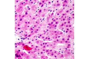 Immunohistochemical analysis of FRS2 (pY436) staining in human liver formalin fixed paraffin embedded tissue section.