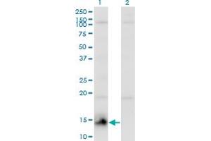 Western Blot analysis of CHURC1 expression in transfected 293T cell line by CHURC1 monoclonal antibody (M01), clone 2F9. (CHURC1 anticorps  (AA 1-112))