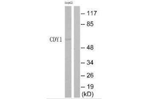 Western blot analysis of extracts from HepG2 cells, using CDY1 antibody. (CDY1 anticorps)