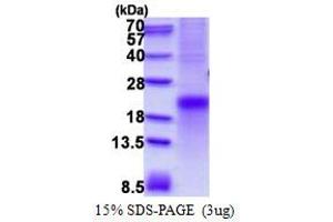 Image no. 1 for Tumor Necrosis Factor Receptor Superfamily, Member 1A (TNFRSF1A) protein (His tag) (ABIN1098686)