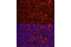 Immunofluorescence analysis of rat spleen using CD4 Rabbit pAb (ABIN6134777, ABIN6138187, ABIN6138189 and ABIN6213821) at dilution of 1:100 (40x lens).