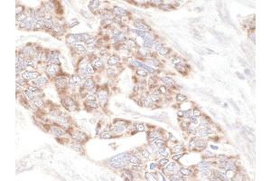 anti-Rap Guanine Nucleotide Exchange Factor (GEF) 2 (RAPGEF2) (AA 975-1025) antibody