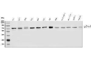 Western blot analysis of P2RX4 using anti-P2RX4 antibody (ABIN3043376).
