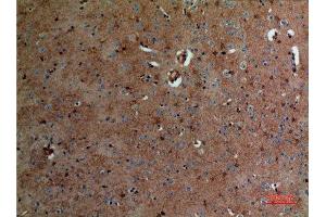 Immunohistochemistry (IHC) analysis of paraffin-embedded Mouse Brain, antibody was diluted at 1:100. (ALDOC anticorps  (N-Term))