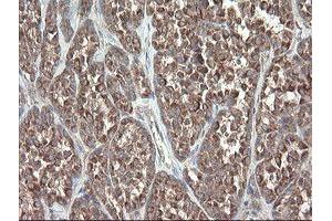 Image no. 14 for anti-Diphthamide Biosynthesis Protein 2 (DPH2) antibody (ABIN1497892)