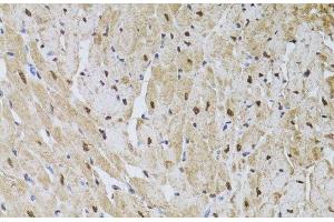 Immunohistochemistry of paraffin-embedded Rat heart using HUS1 Polyclonal Antibody at dilution of 1:100 (40x lens).