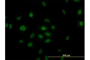 Immunofluorescence of monoclonal antibody to PLK1 on HeLa cell.