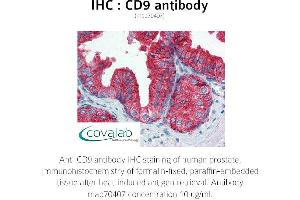 Image no. 1 for anti-CD9 (CD9) antibody (ABIN1723299) (CD9 anticorps)