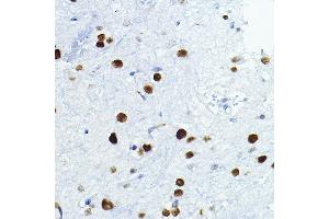 Immunohistochemistry of paraffin-embedded mouse spinal cord using FOSL1 Rabbit pAb (ABIN6131653, ABIN6140738, ABIN6140739 and ABIN6221016) at dilution of 1:100 (40x lens).