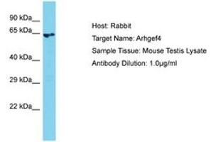Image no. 1 for anti-rho Guanine Nucleotide Exchange Factor (GEF) 4 (ARHGEF4) (AA 51-100) antibody (ABIN6750412) (ARHGEF4 anticorps  (AA 51-100))