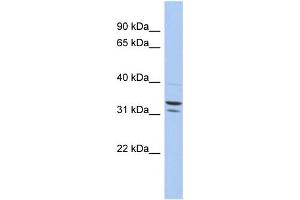 WB Suggested Anti-FAM92B Antibody Titration: 0. (FAM92B anticorps  (N-Term))