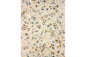 Anti-MTCO1 antibody,  IHC(P) IHC(P): Rat Brain Tissue