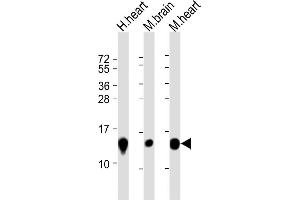 All lanes : Anti-NDUFB3 Antibody (N-Term) at 1:8000 dilution Lane 1: human heart lysate Lane 2: mouse brain lysate Lane 3: mouse heart lysate Lysates/proteins at 20 μg per lane. (NDUFB3 anticorps  (AA 13-45))