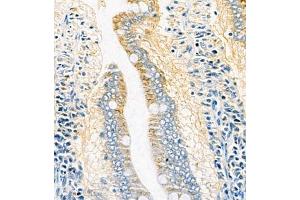 Immunohistochemistry analysis of paraffin embedded rat duodenum using PMCA1 (ABIN7073155) at dilution of 1: 1000
