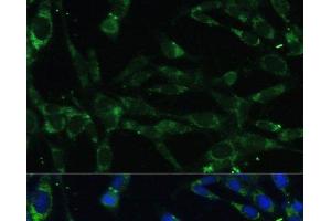 Immunofluorescence analysis of NIH-3T3 cells using CAPN5 Polyclonal Antibody at dilution of 1:100. (Calpain 5 anticorps)