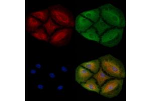 ABIN6265463 and ABIN6278640 staining  cells by IF/ICC.