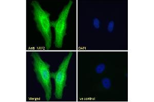 ABIN768601 Immunofluorescence analysis of paraformaldehyde fixed HeLa cells, permeabilized with 0.