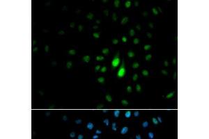 Immunofluorescence analysis of MCF-7 cells using PIN1 Polyclonal Antibody (PIN1 anticorps)