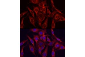 Immunofluorescence analysis of NIH/3T3 cells using VEGFA Rabbit pAb (ABIN6133961, ABIN6150085, ABIN6150087 and ABIN6213765) at dilution of 1:150 (40x lens). (VEGFA anticorps  (AA 111-161))