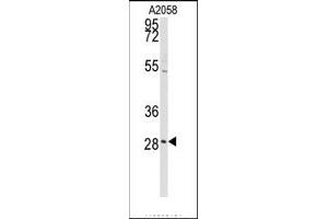 Image no. 1 for anti-Protein Kinase C, delta Binding Protein (PRKCDBP) (Middle Region) antibody (ABIN360096) (PRKCDBP anticorps  (Middle Region))